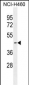 PDHA2 Antibody (Center)